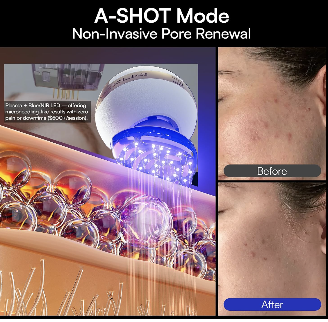 A Shot mode