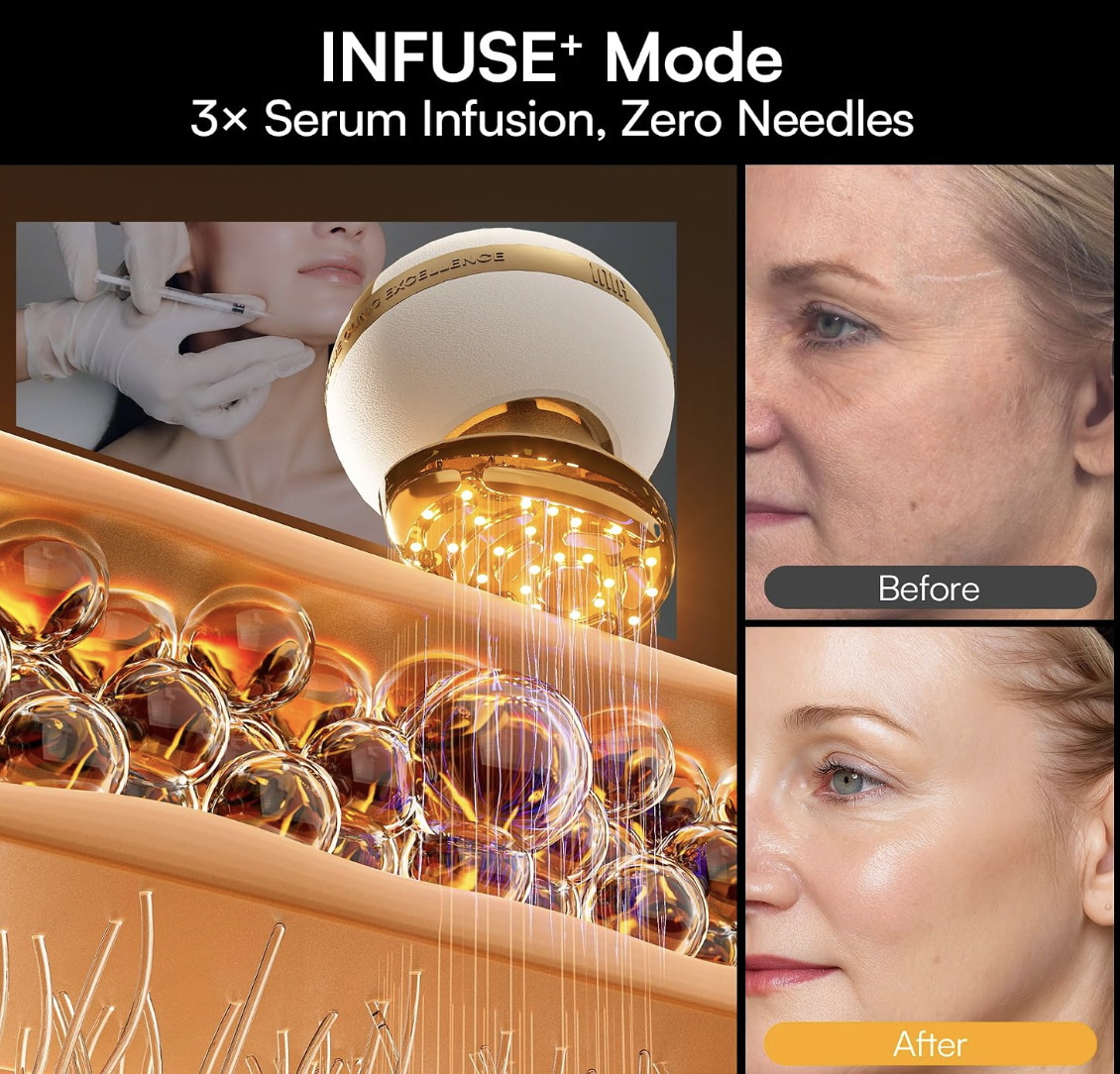 Infuse