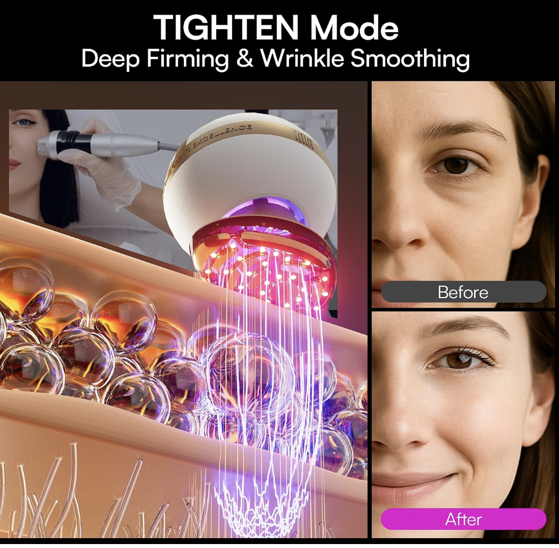 Tighten mode